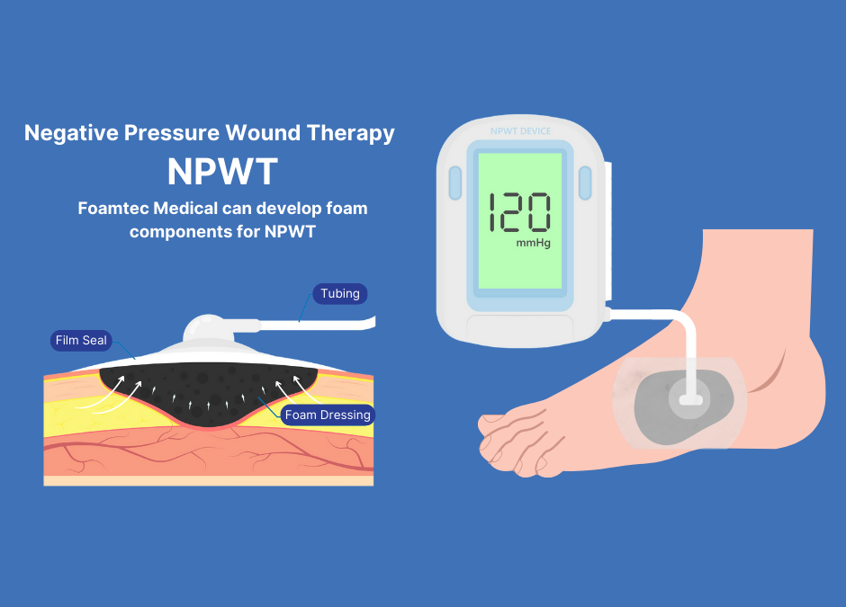 Use of Foam in Negative pressure wound therapy (NPWT)
